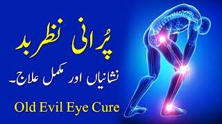 Purani Nazar e Bad Nishaniyan aur Mukamal illaj Hazrat ALi ra ka Farman - Old Evil Eye Cure