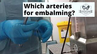 Which arteries do you use to embalm?