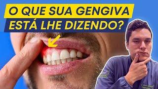 Por Que a Gengiva DÓI E SANGRA Após Passar Fio Dental?