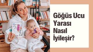 GÖĞÜS UCU İÇİN ÇÖZÜMLER I Gümüş Kapak işe yarıyor mu? Kremler ve diğerleri...