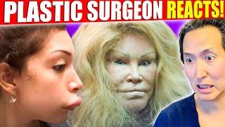 Plastic Surgeon Reacts to WORST Celebrity Surgery DISASTERS