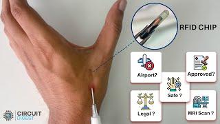Is it Safe? Is it Legal in India? Here is everything you need to know about RFID Chip Implants