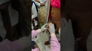 Examination Of Scrotal SwellingPart-2  Scrotal Swelling Short Case for Final Prof Examination