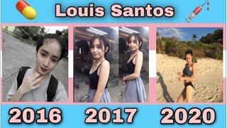 HRT Revealed + Male To Female TRANSITION  Louis Santos 