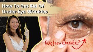 How To Get Rid Of Under-Eye Wrinkles