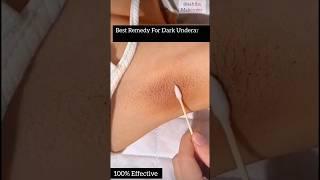 Dark UnderarmsDarkness Remove Easily At Home ll #spotremove #beatytips #skincare #ytshorts #viral