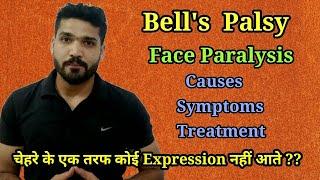 Bells Palsy  Facial Paralysis Causes Symptoms and Treatment