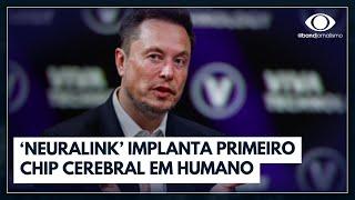 Empresa de Elon Musk faz 1º implante de chip cerebral em humano  Jornal da Band