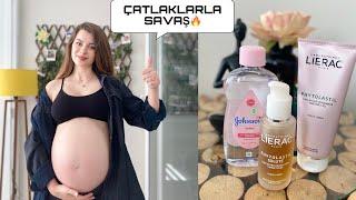 HAMİLELİK ÇATLAKLARI  ÇATLAKLARLA SAVAŞ 