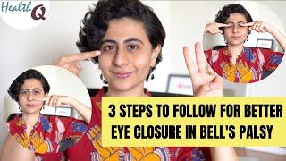 3 STEPS TO FOLLOW FOR BETTER EYE CLOSURE IN BELLS PALSY