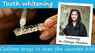 Whitening trays vs over the counter whitening kits