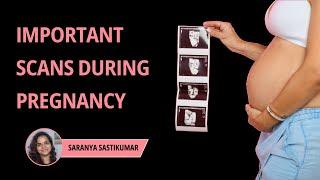 4 Important Scans During Pregnany  Ultrasound Scans During Pregnancy