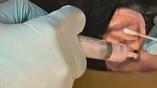 ASMR Cranial Nerve Exam for your Ears  Ear Cleaning Ultrasound Doctor & Patient POV