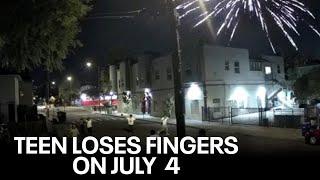 Fireworks explosion costs football players his fingers in Berkeley on July 4  KTVU