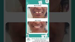 Smile Kochi Dental Clinic  Kadavanthara  PalarivattomSmile Kochi Dental Clinic