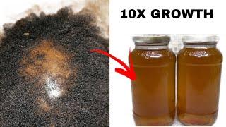 HAIR GROWTH treatment that will grow your HAIR extremely faster April 29 2024