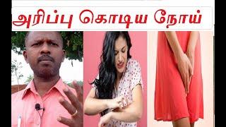 அரிப்பு .  அரிப்பு ..  அரிப்பு ... - இத்தனை நாள் இது தெரியாம போச்சே ..