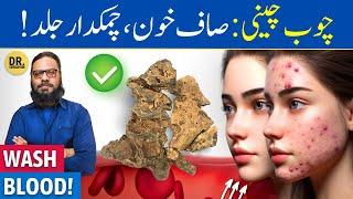 Chop-Chini Ke Fayde Khoon Ki Safai & Jild Ke Bemaria  Smilax China Root  Dr. Ibrahim