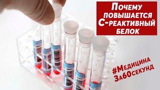 Высокий C-реактивный белок  Причины высокого С-рб  Почему повышен СРБ в крови