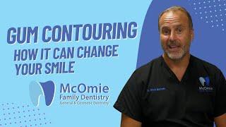 How Gum Contouring Can Change Your Gummy Smile  Dr. McOmie Explains What You Need To Know