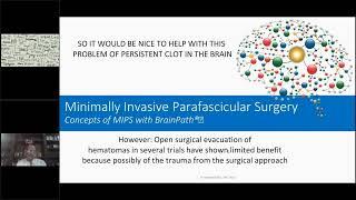 Minimally Invasive Surgery for Stroke and ICH