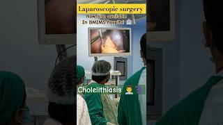 Laparoscopy surgery of gall bladder stone  #cholelithiasis #surgery#OT #ytshorts#shortsfeed#medios