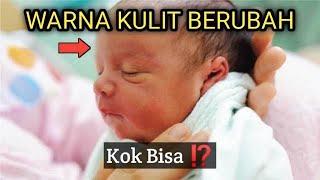 Warna Kulit Bayi dapat Berubah.. Kapan Keluar Warna Kulit Aslinya?  Cek disini faktanya..