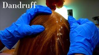 ASMR Soothing  Scalp Check Dandruff Removal  Sleep Inducting  No Talking 