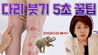 다리 붓기 없애는 5초 꿀팁 여기만 꾹꾹 눌러주면 코끼리 다리 빠이빠이