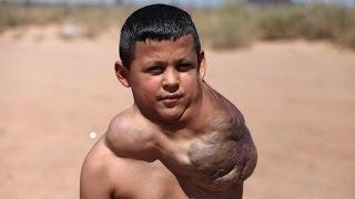 Ten Year Old Has Giant Neck Tumour Body Bizarre Episode 1