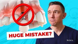 Top 5 Reasons You Should NOT Get Dental Implants