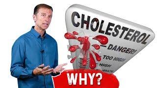 Why Do You Get High Cholesterol After Intermittent Fasting? – Dr.Berg