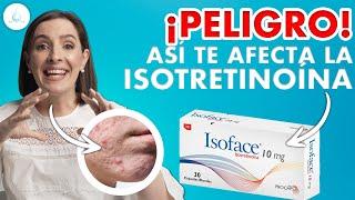  TODO sobre la ISOTRETINOINA. Roaccutan - Accutane - Isoface @drapilarochoa - Dermatologa