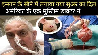 डाक्टर ने इन्सान के सीने में लगाया गया एक सुअर का दिल।।Real story of pic heart transplant to human