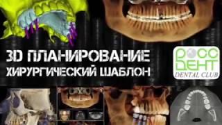 Планирование ортопедического протокола. Учебный центр Росс-Дент