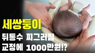 세쌍둥이 전부 다 사두증 ?ㅣ셀프 두상교정 스트레칭ㅣ두상교정헬맷ㅣ아기 두상 만들기ㅣ3개월 4개월 아가ㅣ현실 육아 24시간ㅣ육아 브이로그ㅣ출산장려ㅣ아기ㅣVLOG