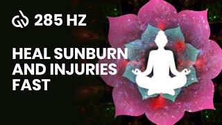 285 Hz Wound Healing Frequency Heal Burn & Injuries Sunburn Subliminal