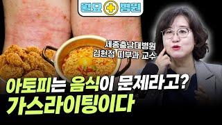 아토피·여드름은 음식 탓? 피부과 교수가 딱 정리해드림