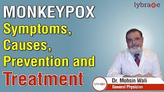 Monkeypox Symptoms Causes Prevention and Treatment - Dr. Mohsin Wali  Lybrate