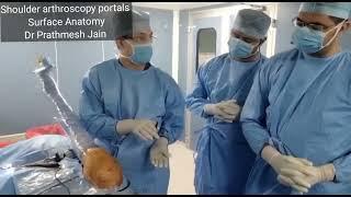 Shoulder Anatomy portals by Dr Prathmesh Jain