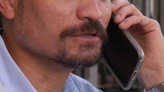 Video Facial hair transplants for men