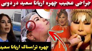 چهره جدید اریانا سعید و یک میلیون دالر هزینه جراحی اریانا سعید اما چرا؟Aryana Sayeed