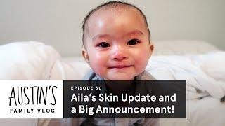 Ailas Skin Update and a Big Announcement  Austin Vlog  HiHo Kids