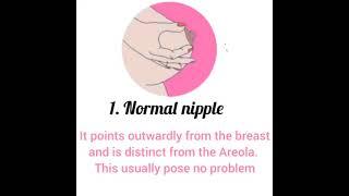 Types of Nipple