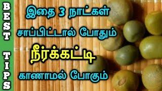 PCOD problem solution in Tamil  Home Remedy  Best Tips  complete cure