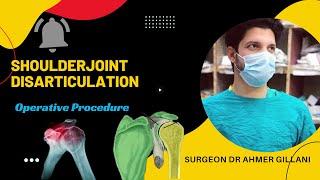 Shoulder Disarticulation  Upper limb amputation \ Complete Operation For Electric Shock