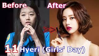 TOP 20 Korean Idols Before and After Plastic Surgery