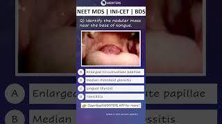 NEET MDS  INI-CET MDS  PSC  BDS - Most Important Questions  #neetmds2025 #mdsprep