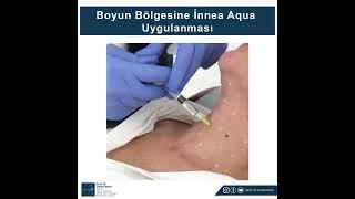 BOYUNA İNNEA AQUA UYGULAMASI BİYOLOJİK LİFTİNG AŞISI