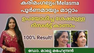 കരിമംഗല്യം ഇനിയൊരു പ്രശ്നമല്ല Herbal Anti Melasma Face pack  Mukhavarnya Tailam #melasmatreatment